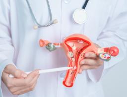 Fibroids